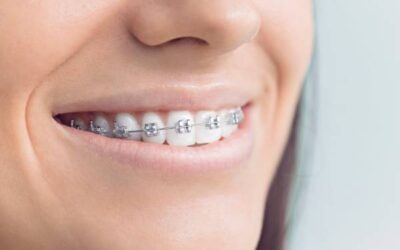 Choosing the Best Orthodontist in Dubai: Dr. Basel Mofti’s Expertise